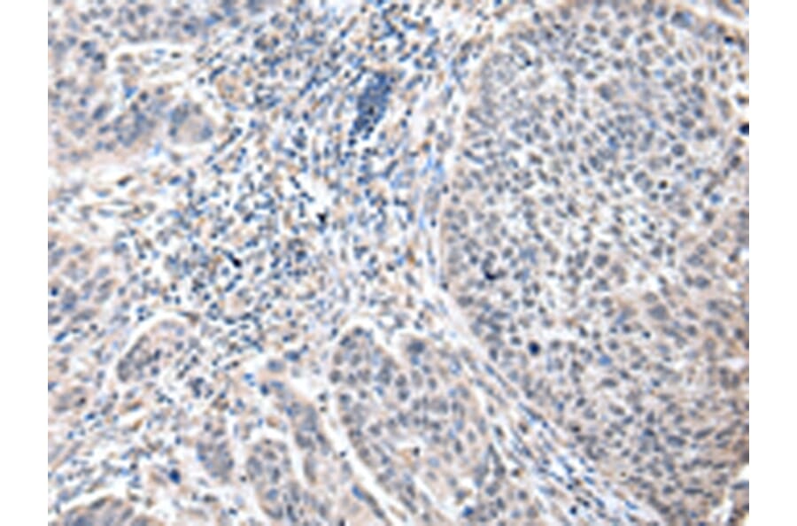 Immunohistochemistry - ZFP64 Antibody from Signalway Antibody (42872) - Antibodies.com