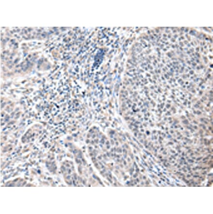 Immunohistochemistry - ZFP64 Antibody from Signalway Antibody (42872) - Antibodies.com