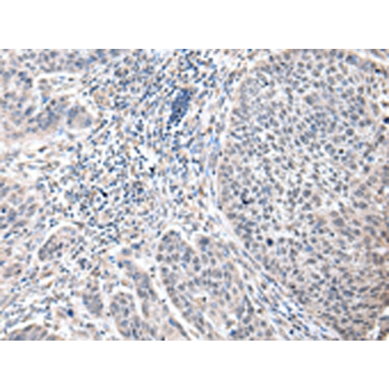 Immunohistochemistry - ZFP64 Antibody from Signalway Antibody (42872) - Antibodies.com