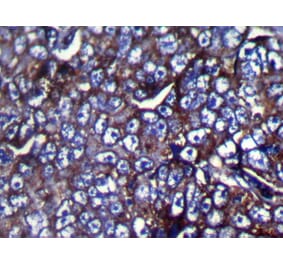 Immunohistochemistry - ZFP91 Antibody from Signalway Antibody (42873) - Antibodies.com