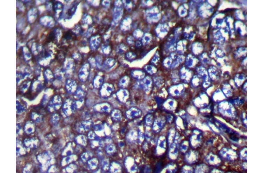 Immunohistochemistry - ZFP91 Antibody from Signalway Antibody (42873) - Antibodies.com