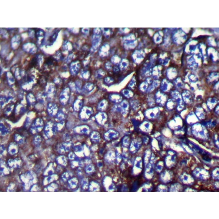 Immunohistochemistry - ZFP91 Antibody from Signalway Antibody (42873) - Antibodies.com