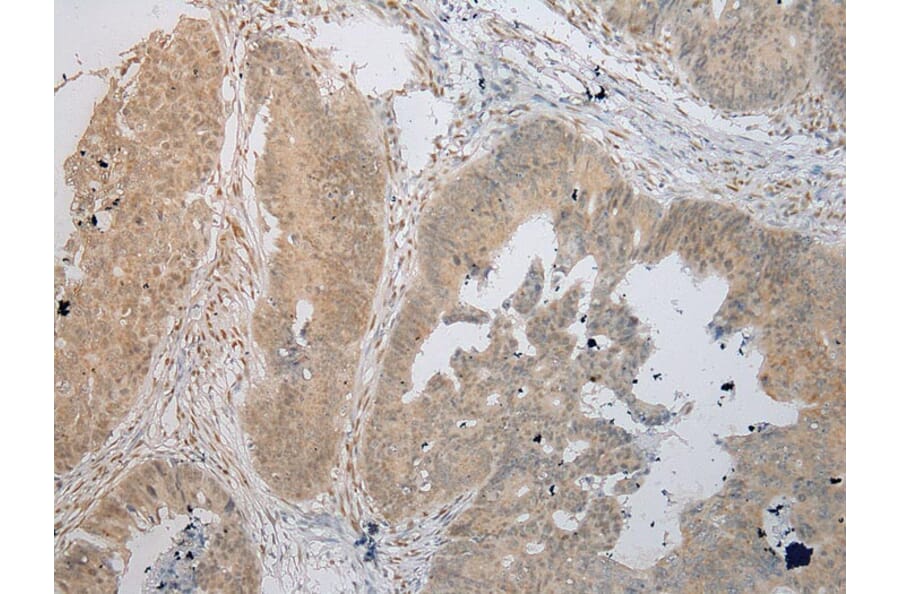 Immunohistochemistry - TIGD5 Antibody from Signalway Antibody (42884) - Antibodies.com