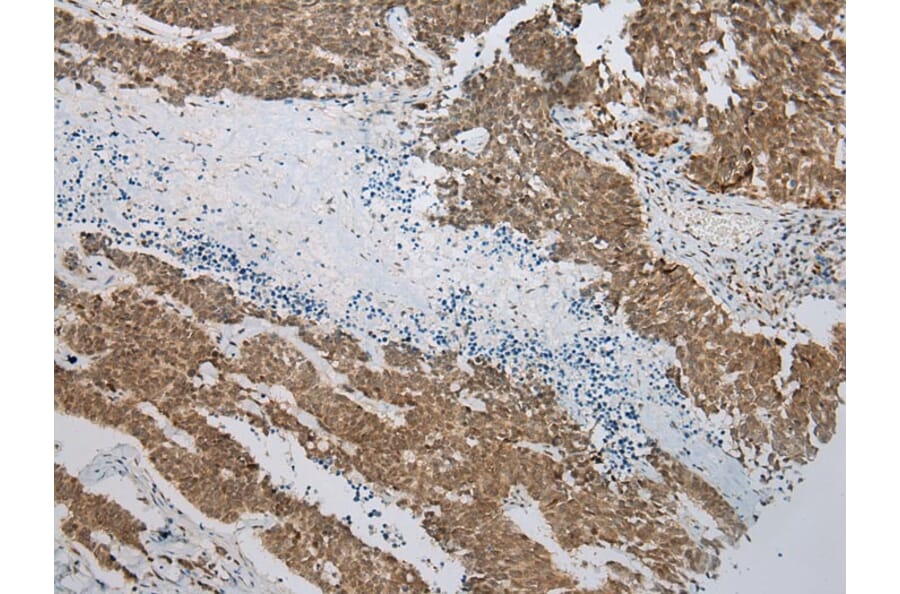 Immunohistochemistry - TIGD5 Antibody from Signalway Antibody (42884) - Antibodies.com