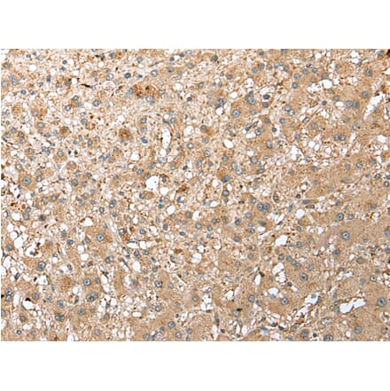 Immunohistochemistry - RPS21 Antibody from Signalway Antibody (42889) - Antibodies.com