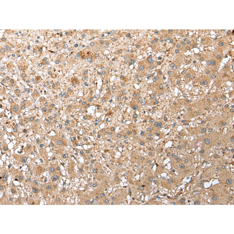 Immunohistochemistry - RPS21 Antibody from Signalway Antibody (42889) - Antibodies.com