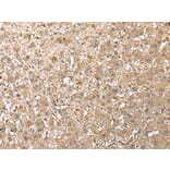 Immunohistochemistry - RPS21 Antibody from Signalway Antibody (42889) - Antibodies.com