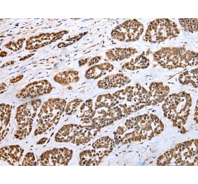 Immunohistochemistry - HIF1A Antibody from Signalway Antibody (42895) - Antibodies.com