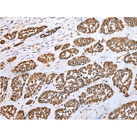 Immunohistochemistry - HIF1A Antibody from Signalway Antibody (42895) - Antibodies.com