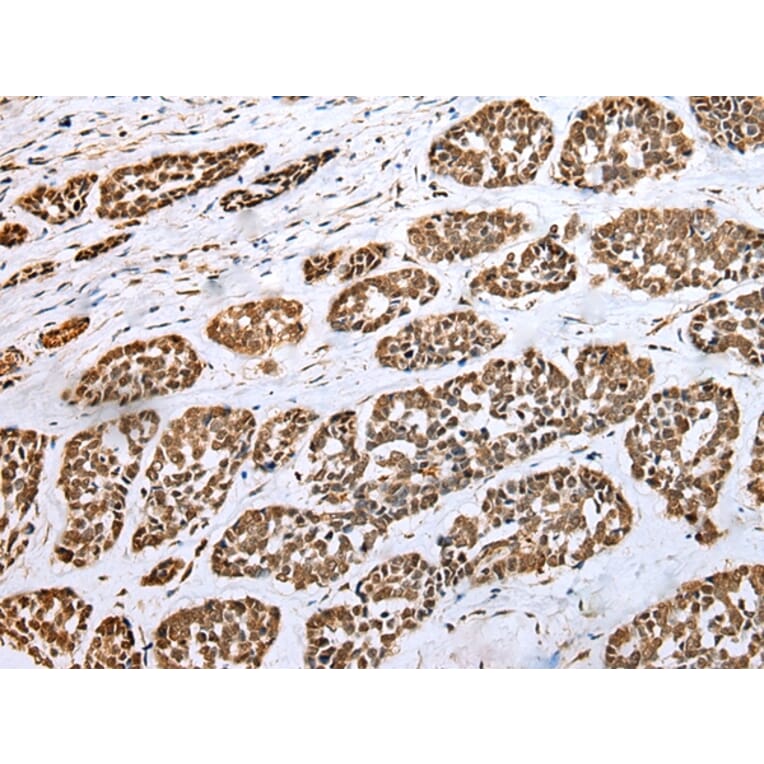 Immunohistochemistry - HIF1A Antibody from Signalway Antibody (42895) - Antibodies.com