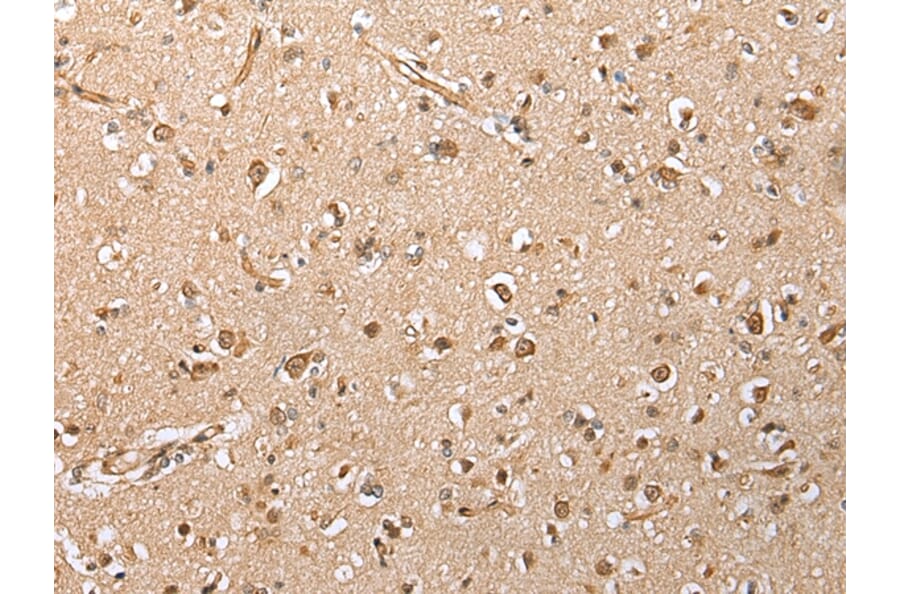 Immunohistochemistry - HIF1A Antibody from Signalway Antibody (42895) - Antibodies.com