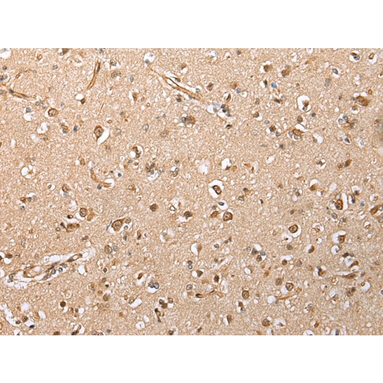 Immunohistochemistry - HIF1A Antibody from Signalway Antibody (42895) - Antibodies.com