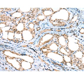 Immunohistochemistry - DTWD1 Antibody from Signalway Antibody (42903) - Antibodies.com