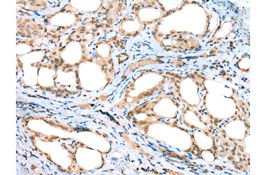Immunohistochemistry - DTWD1 Antibody from Signalway Antibody (42903) - Antibodies.com