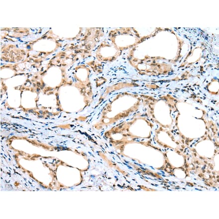 Immunohistochemistry - DTWD1 Antibody from Signalway Antibody (42903) - Antibodies.com