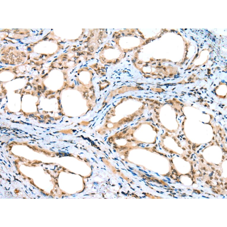 Immunohistochemistry - DTWD1 Antibody from Signalway Antibody (42903) - Antibodies.com