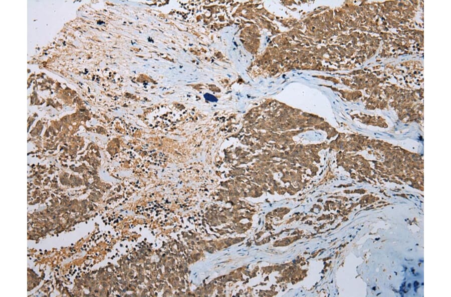 Immunohistochemistry - PHTF2 Antibody from Signalway Antibody (42907) - Antibodies.com