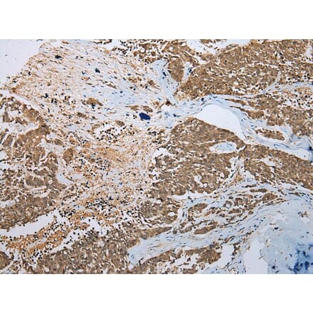 Immunohistochemistry - PHTF2 Antibody from Signalway Antibody (42907) - Antibodies.com