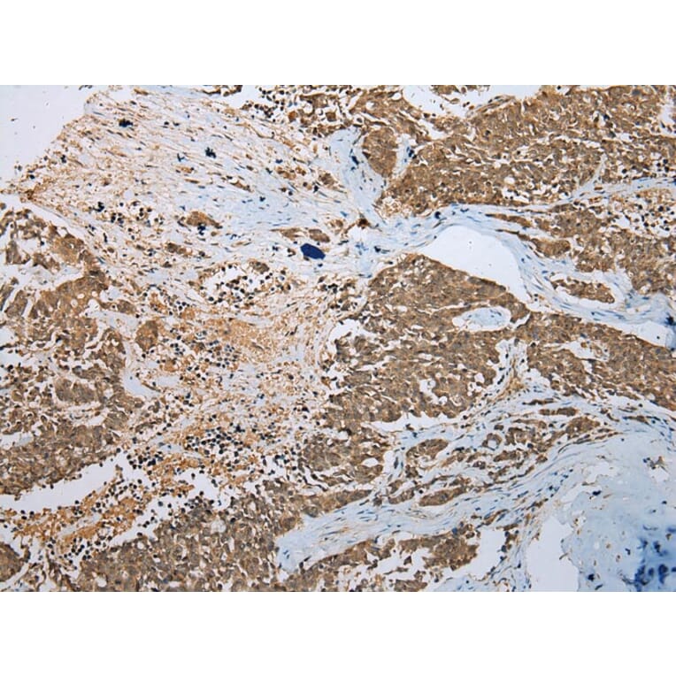 Immunohistochemistry - PHTF2 Antibody from Signalway Antibody (42907) - Antibodies.com