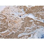 Immunohistochemistry - PHTF2 Antibody from Signalway Antibody (42907) - Antibodies.com