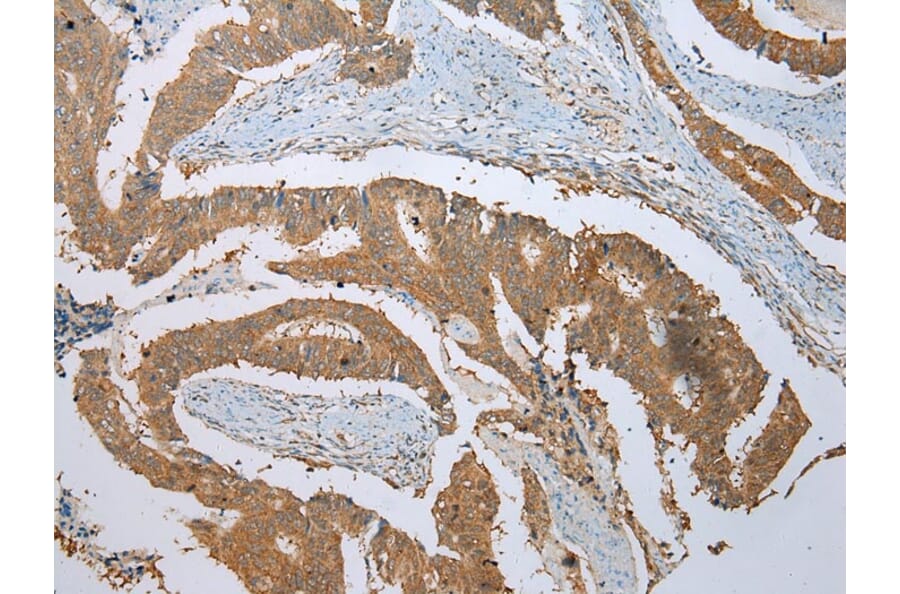 Immunohistochemistry - PHTF2 Antibody from Signalway Antibody (42907) - Antibodies.com