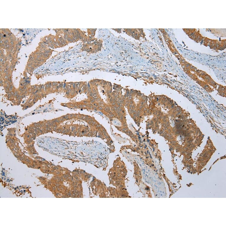 Immunohistochemistry - PHTF2 Antibody from Signalway Antibody (42907) - Antibodies.com