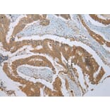 Immunohistochemistry - PHTF2 Antibody from Signalway Antibody (42907) - Antibodies.com