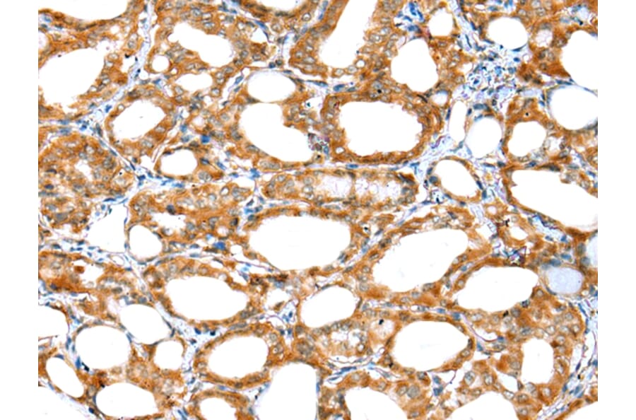 Immunohistochemistry - ERMP1 Antibody from Signalway Antibody (42909) - Antibodies.com
