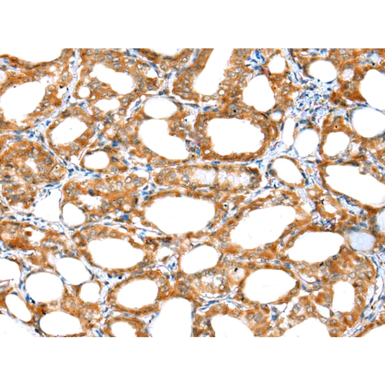 Immunohistochemistry - ERMP1 Antibody from Signalway Antibody (42909) - Antibodies.com