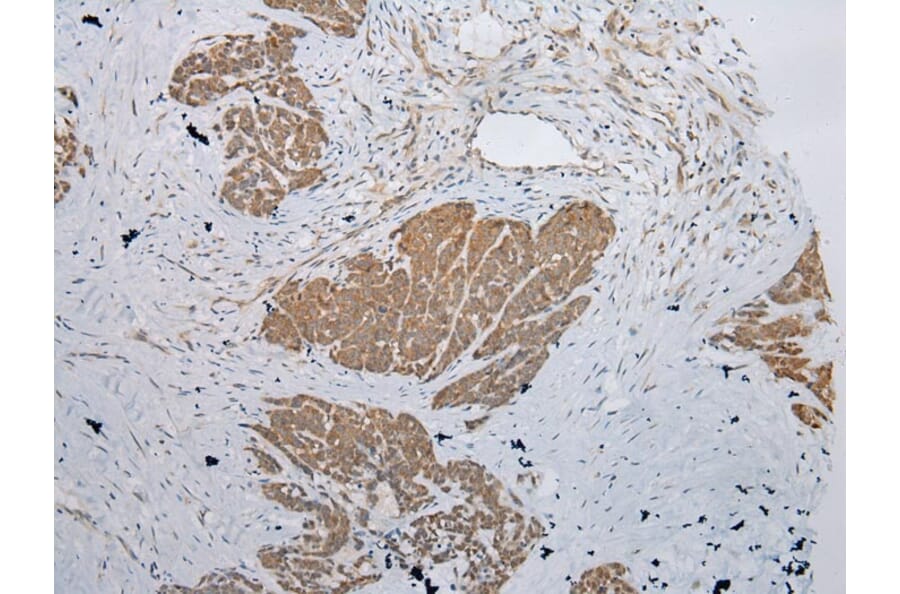 Immunohistochemistry - CBWD1 Antibody from Signalway Antibody (42912) - Antibodies.com