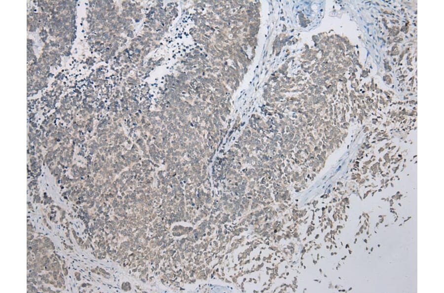 Immunohistochemistry - CBWD1 Antibody from Signalway Antibody (42912) - Antibodies.com