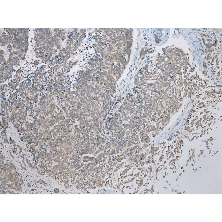 Immunohistochemistry - CBWD1 Antibody from Signalway Antibody (42912) - Antibodies.com