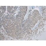 Immunohistochemistry - CBWD1 Antibody from Signalway Antibody (42912) - Antibodies.com