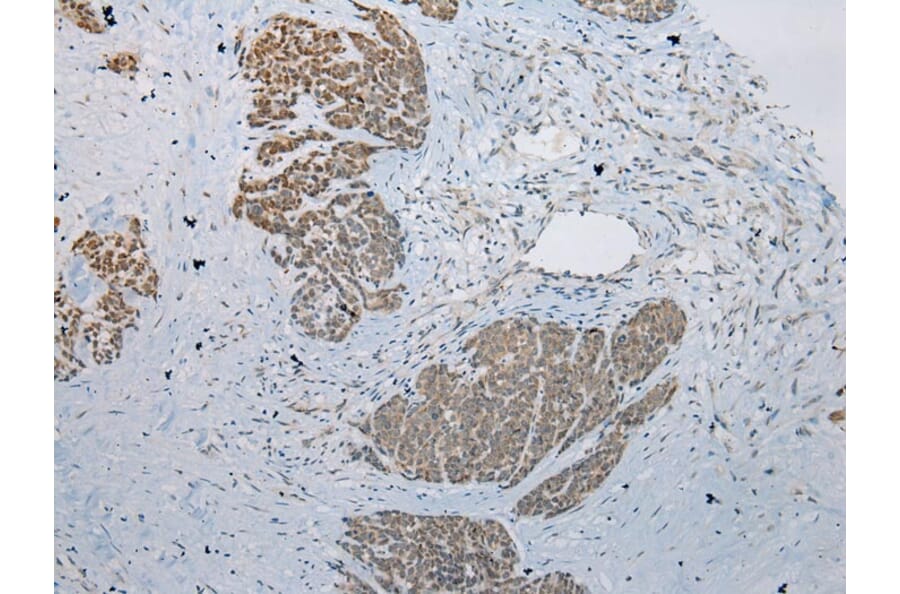Immunohistochemistry - LSM11 Antibody from Signalway Antibody (42915) - Antibodies.com