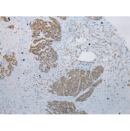 Immunohistochemistry - LSM11 Antibody from Signalway Antibody (42915) - Antibodies.com
