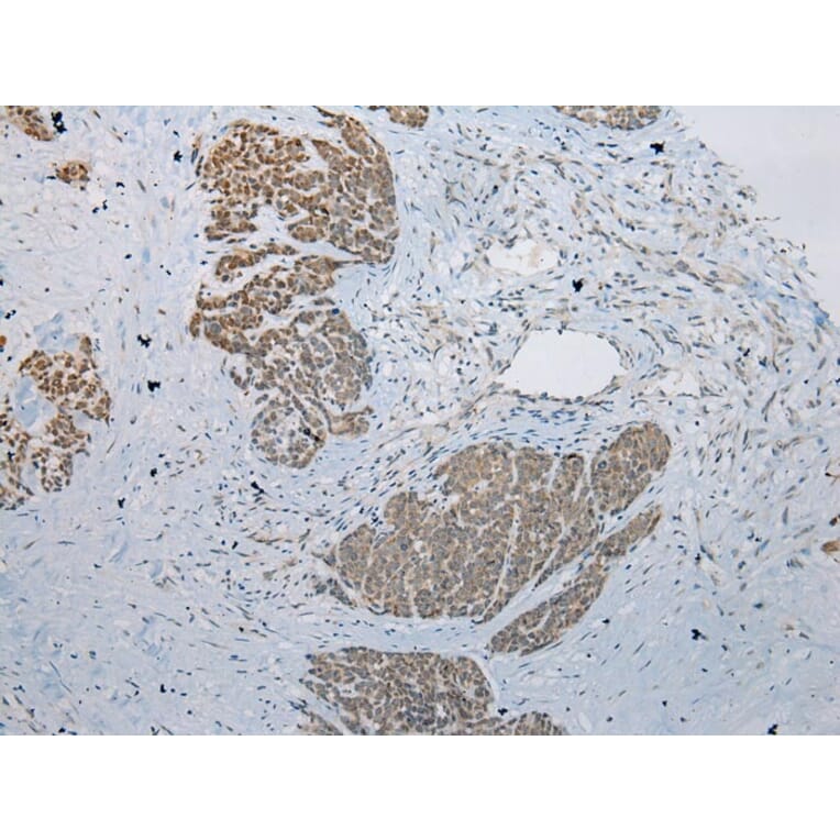 Immunohistochemistry - LSM11 Antibody from Signalway Antibody (42915) - Antibodies.com