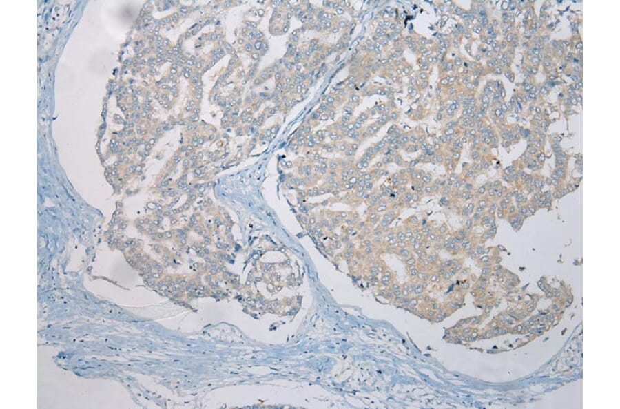 Immunohistochemistry - LSM11 Antibody from Signalway Antibody (42915) - Antibodies.com