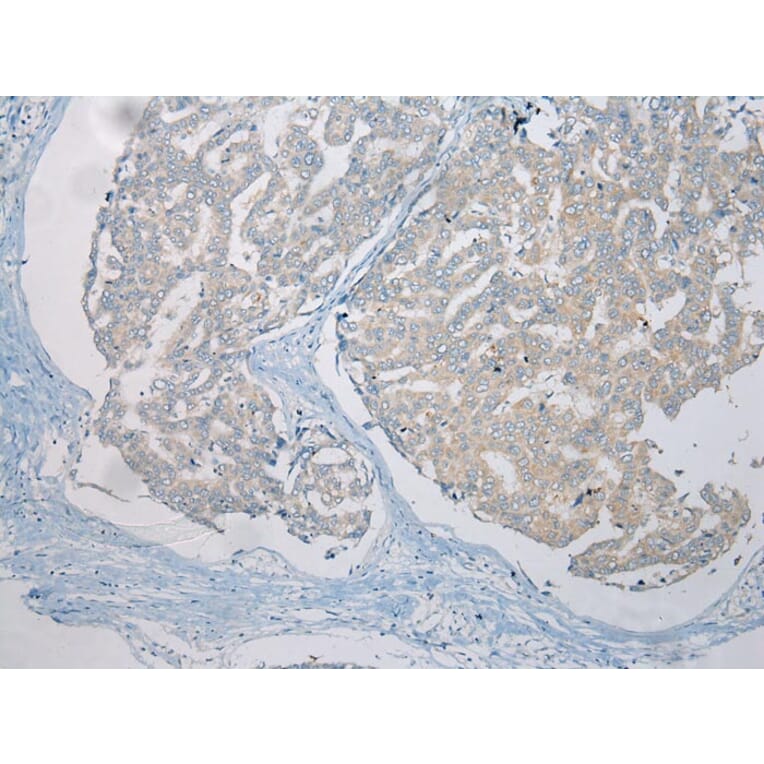 Immunohistochemistry - LSM11 Antibody from Signalway Antibody (42915) - Antibodies.com