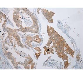 Immunohistochemistry - CASP5 Antibody from Signalway Antibody (42920) - Antibodies.com