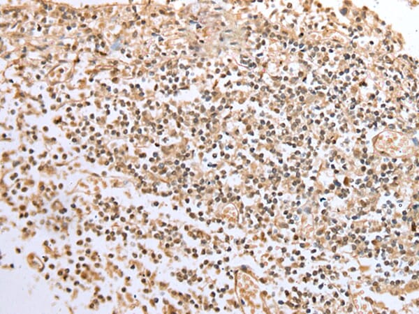 Immunohistochemical analysis of paraffin-embedded Human tonsil tissue using #42922 at dilution 1/20,