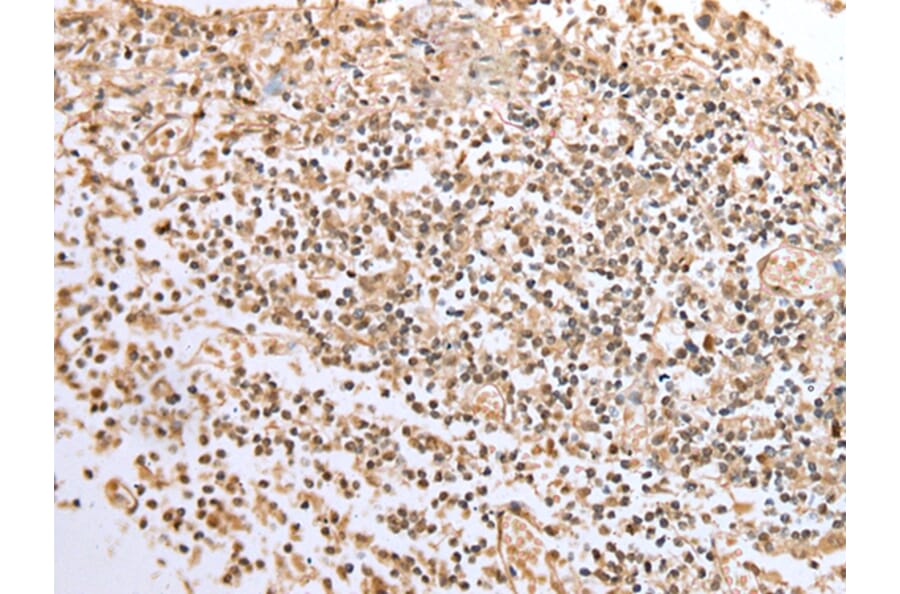 Immunohistochemistry - BCL7A Antibody from Signalway Antibody (42922) - Antibodies.com