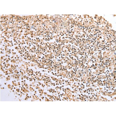 Immunohistochemistry - BCL7A Antibody from Signalway Antibody (42922) - Antibodies.com