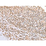 Immunohistochemistry - BCL7A Antibody from Signalway Antibody (42922) - Antibodies.com