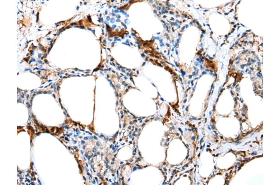 Immunohistochemistry - TCTE3 Antibody from Signalway Antibody (42926) - Antibodies.com