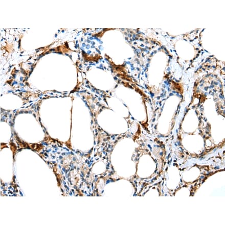 Immunohistochemistry - TCTE3 Antibody from Signalway Antibody (42926) - Antibodies.com