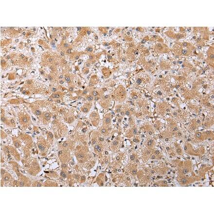 Immunohistochemistry - RAB41 Antibody from Signalway Antibody (42934) - Antibodies.com