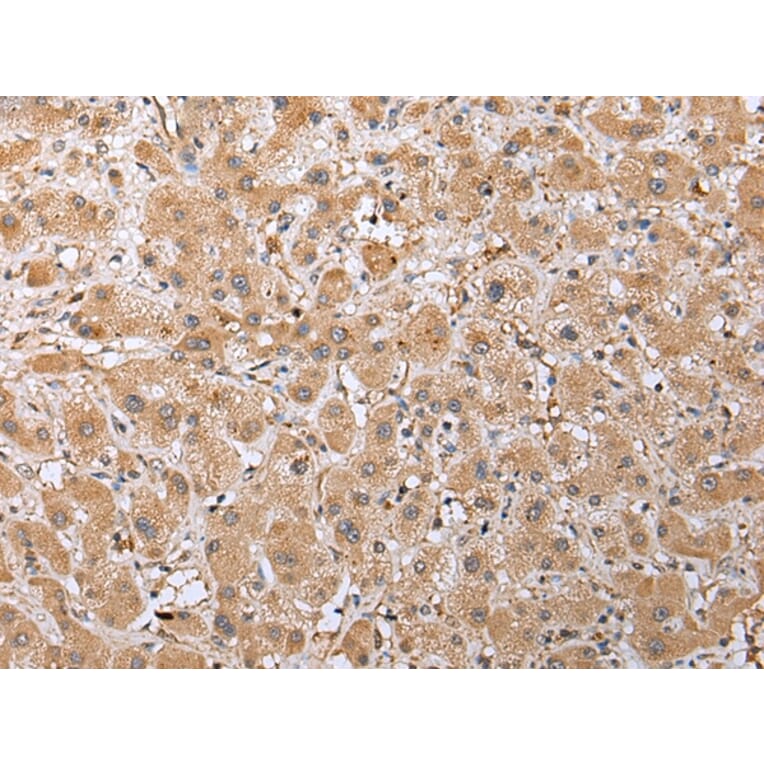 Immunohistochemistry - RAB41 Antibody from Signalway Antibody (42934) - Antibodies.com