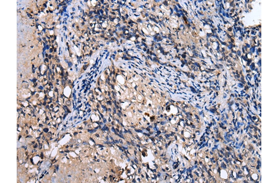 Immunohistochemistry - RAB41 Antibody from Signalway Antibody (42934) - Antibodies.com