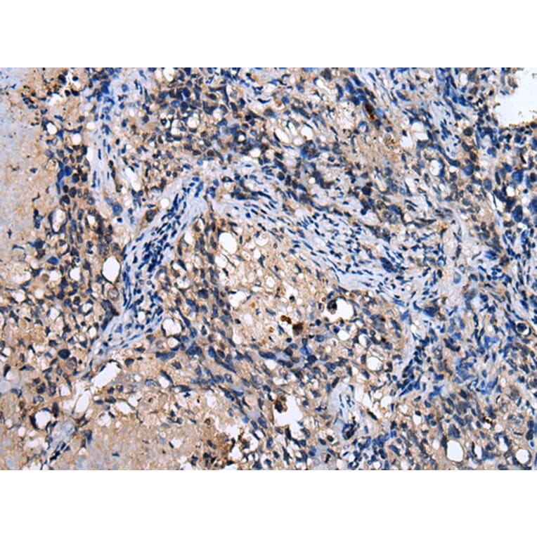 Immunohistochemistry - RAB41 Antibody from Signalway Antibody (42934) - Antibodies.com