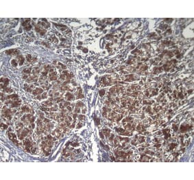 Immunohistochemistry - RPS15 Antibody from Signalway Antibody (42938) - Antibodies.com